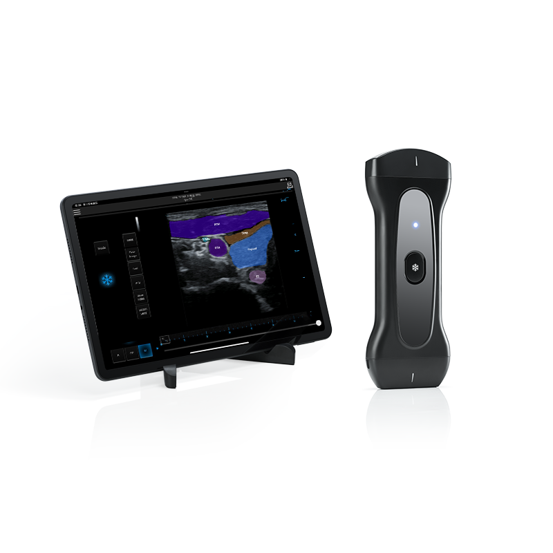 AI-Powered USG Device in Neck Ultrasound Diagnostics