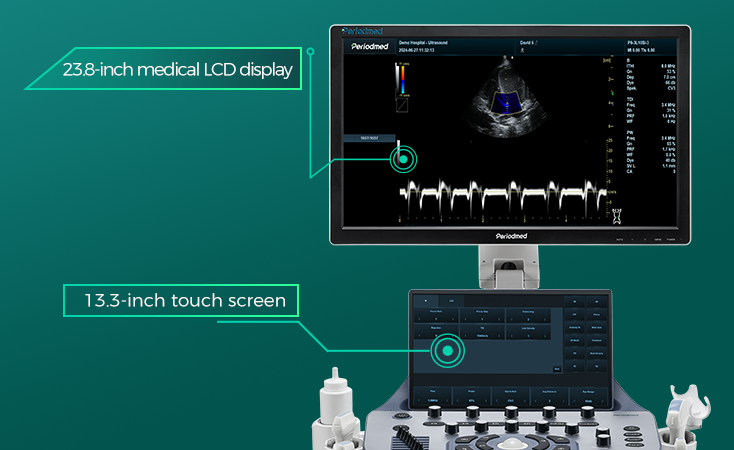 touch screen
