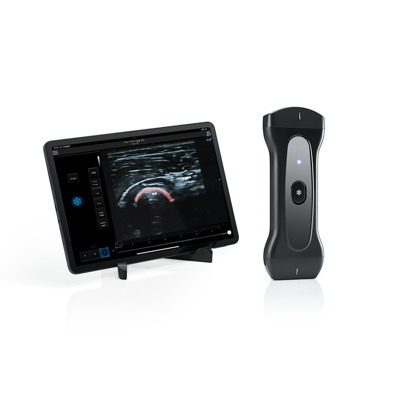 Sports Medicine Ultrasound – Handheld MSK Solution for Athletes | PAU2A