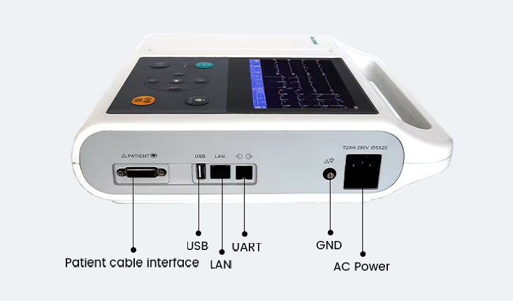 ECG side view