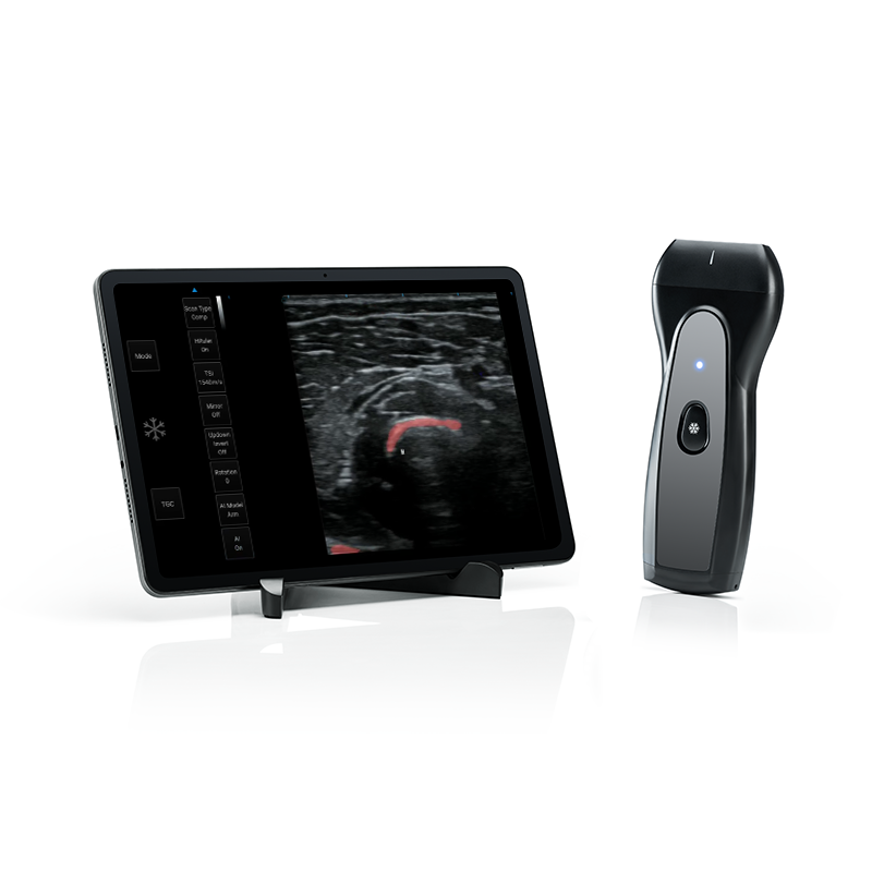 Best MSK Ultrasound Machine PAU1A