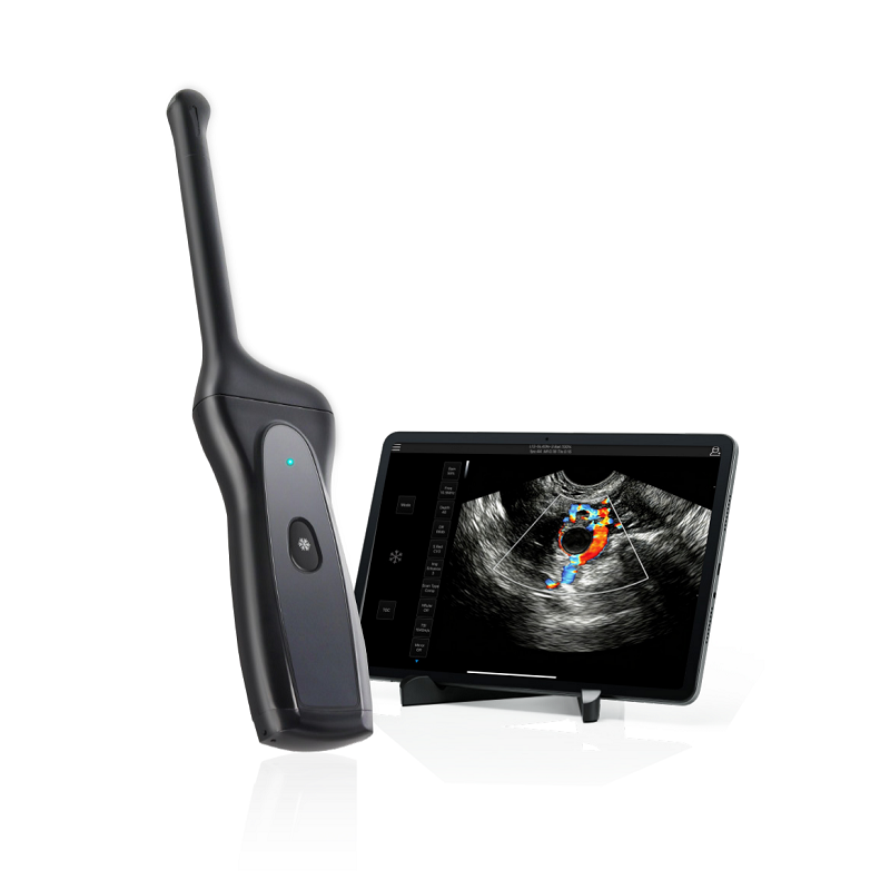 Wireless Transvaginal Ultrasound for OB/GYN Practice | Handheld Pelvic Ultrasound Probe
