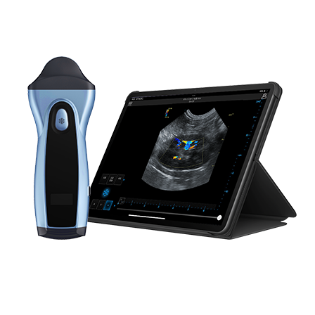 Portable Ultrasound for Panda Abdominal Organ Imaging VPIU1D