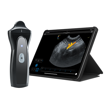 Reptile Veterinary Ultrasound System for Cold-Blooded Animal Exams VPAU1D