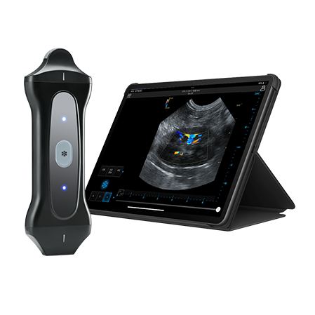 Best Farm Animal Veterinary Ultrasound Scanner with Clear Imaging VPAU2B