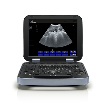 Portable Vet Ultrasound Machine for Pet Hospital PU-VDL153A