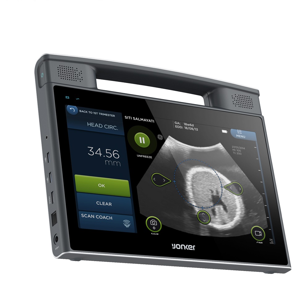 Portable Tablet Touch Screen Ultrasound Machine COMING SOON