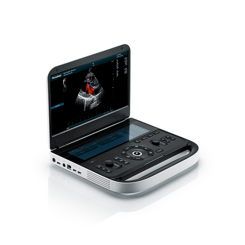High-End Laptop Cardiac Ultrasound